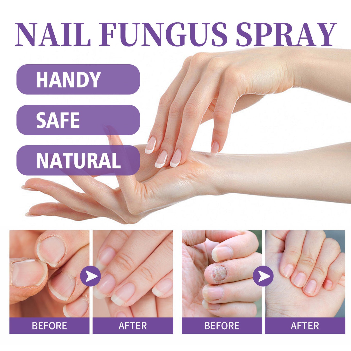 Nail Repair Spray